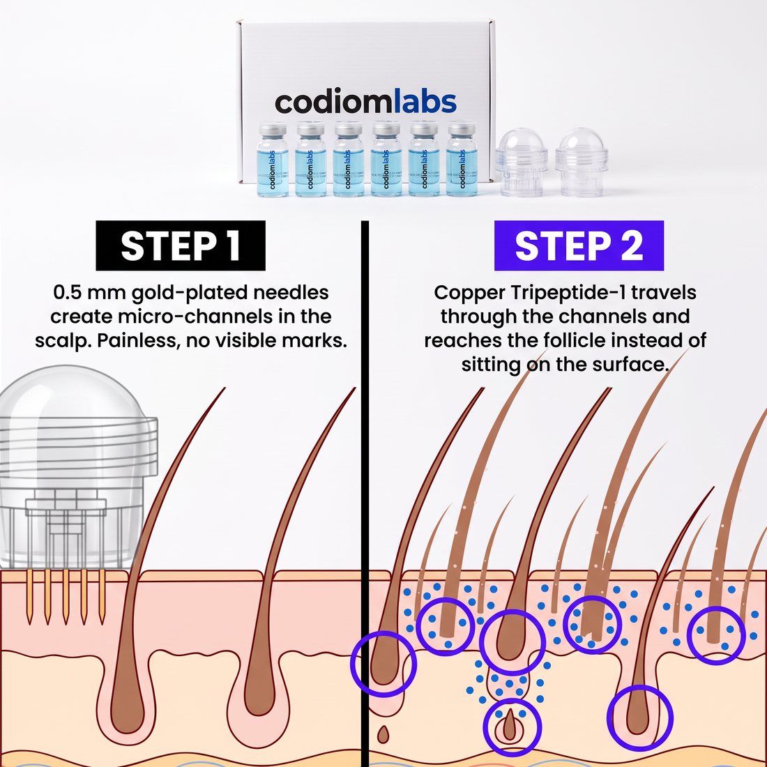 How micro-infusion works